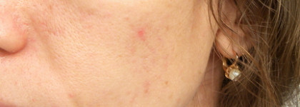 La Roche Posay Hydraphase HA Yeux прекрасный гель для кожи вокруг глаз