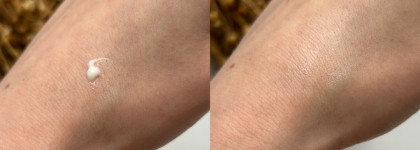 Избавляемся от пигментации вместе с сывороткой Eucerin Anti-Pigment Dual Serum. Фото до/после