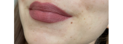 Избавляемся от пигментации вместе с сывороткой Eucerin Anti-Pigment Dual Serum. Фото до/после