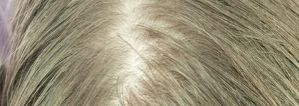 Нет, не умерла. Бюджетное очищение для капризной кожи со смузи от Shauma Энергия природы