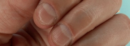 История отвратительных ногтей. Шикарный аевит, паршивый карбон и маслице от Librederm