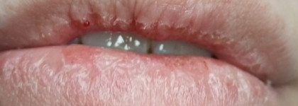 Топ-3 бюджетных продукта для губ зимы 2023/24