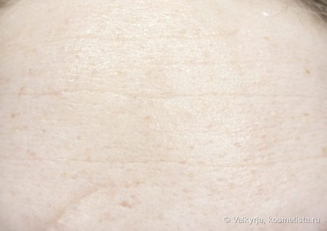 С последующим уходом