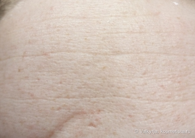 После применения маски