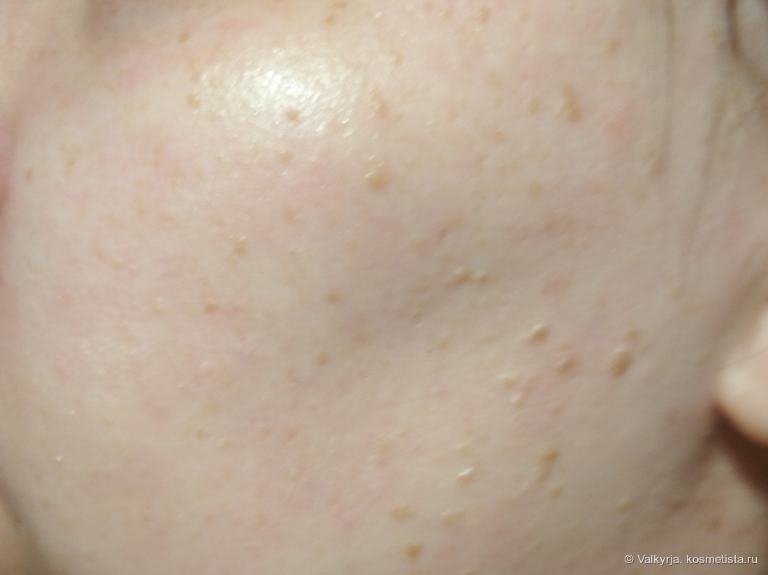 После нанесения