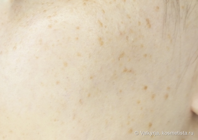 кожа лица после геля для умывания