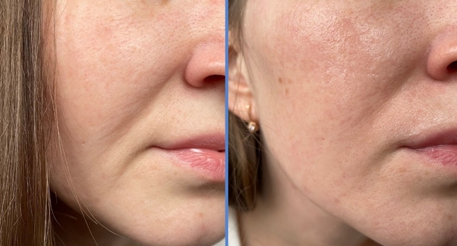 Нежный гель для умывания DON'T TOUCH MY SKIN Cleanser