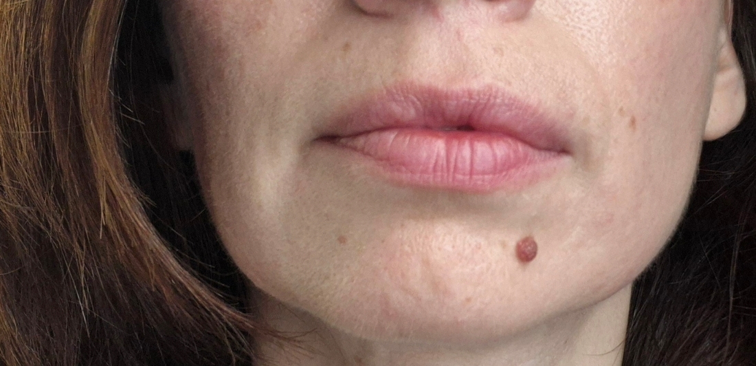 Губы до нанесения бальзама