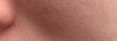 Что изменилось в моем уходе за чувствительной кожей за этот год