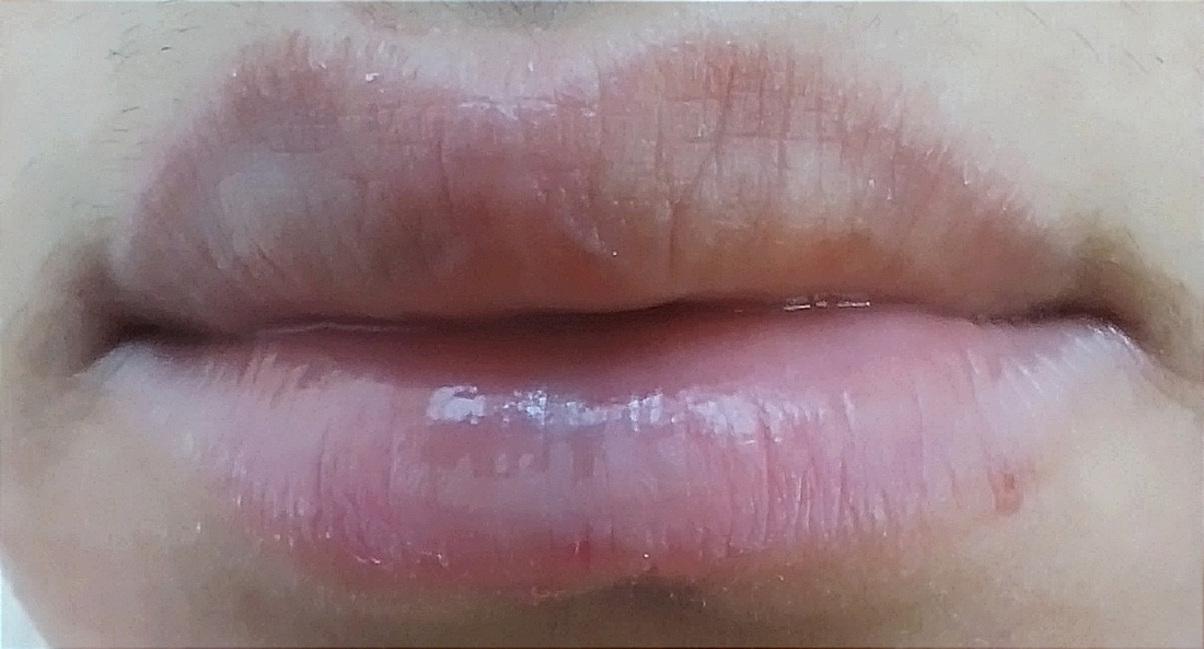 Голые губы