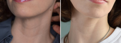 Мой любимый корейский бренд Medi-Peel: уходовая косметика для красоты и молодости кожи