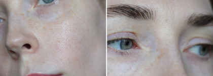 Hidehere: идеальный формат средств для путешествий и не только