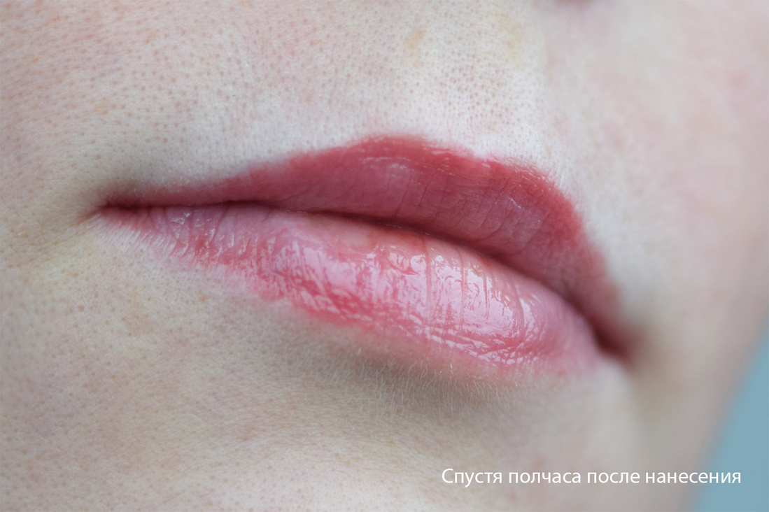 Губы после впитывания плампера