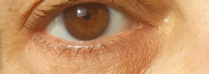 Сравниваем корейские патчи El'Skin, Scinlite: тканевые, фольгированные, гелевые