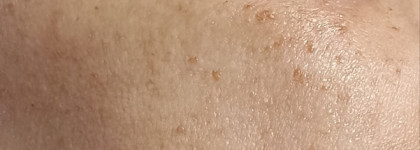 Крем для лица Skinlite "Гиалуроновая кислота х 3"