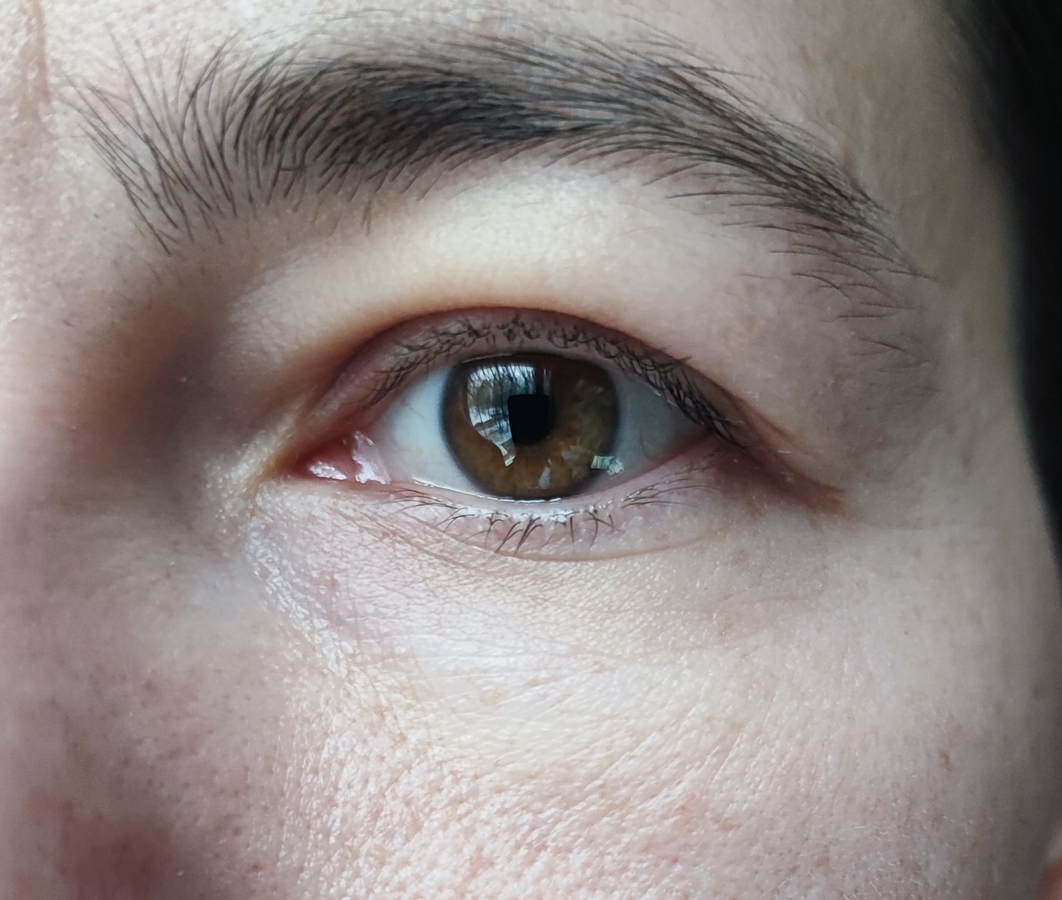 Кожа после нанесения крема