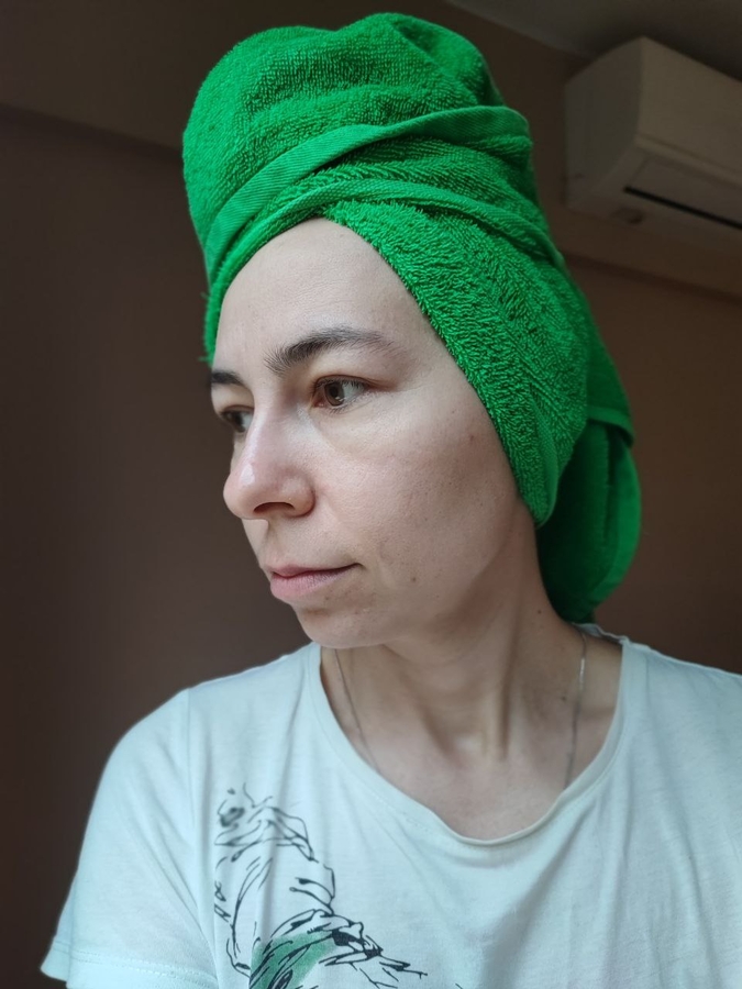 В профиль. Хорошо видент наметившийся птоз, мое нависшее веко, таким оно было всегда