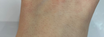 Librederm Cerafavit Cream: спасение при сухой коже тела и лица