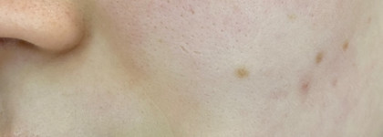 Невидимый результат: Seveki Мультифункциональная сыворотка для лица с ниацинамидом 5%