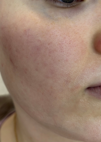 Don't Touch My Skin Don’t Touch My Hydration: первый продукт бренда, который понравился
