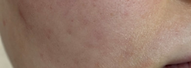 Don't Touch My Skin Don’t Touch My Hydration: первый продукт бренда, который понравился