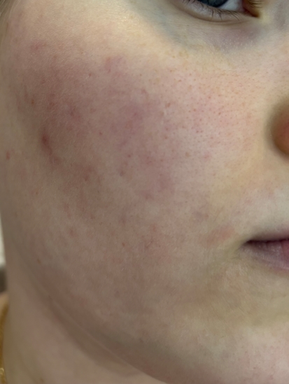 Don't Touch My Skin Don’t Touch My Hydration: первый продукт бренда, который понравился