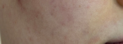 Don't Touch My Skin Don’t Touch My Hydration: первый продукт бренда, который понравился