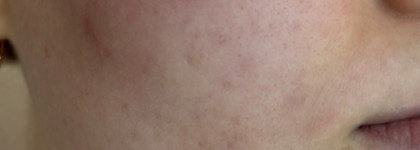 Don't Touch My Skin Don’t Touch My Hydration: первый продукт бренда, который понравился