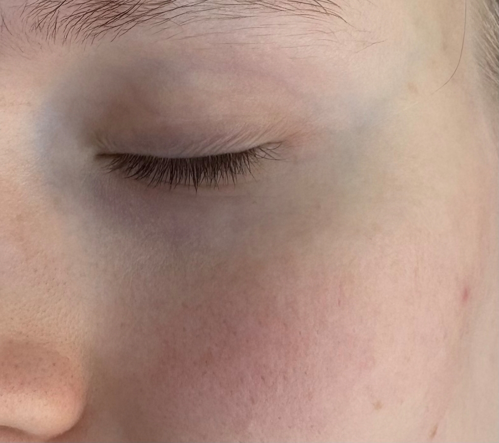 Ресницы "До"