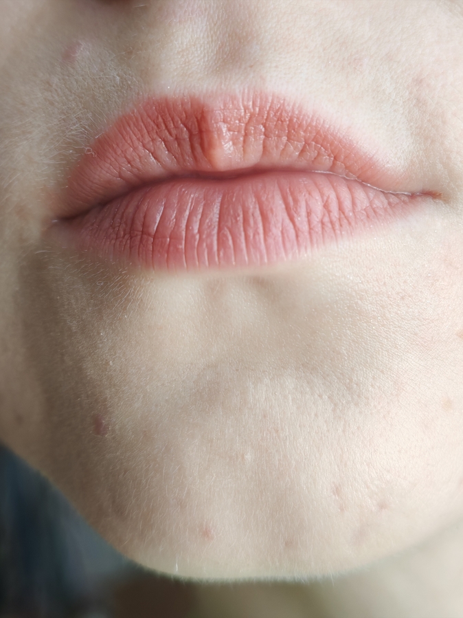 Исчезает аккуратно.