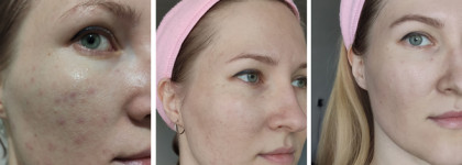 Два продукта от Uriage, или как я перестала умываться и мне стало лучше