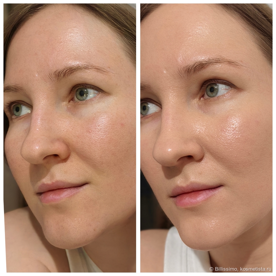 До/после с другой стороны