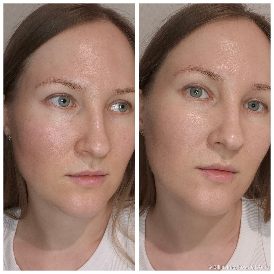 До/после с одной стороны