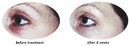 Крем для кожи вокруг глаз с любопытным составом - Mixit Your Skin Normal to Dry Moisture Lifting Eye Cream