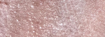 Мой любимый Medi-Peel - лучшее/худшее и много роз