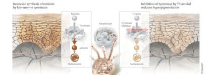 Неподражаемый фаворит 2024 - линия Eucerin Anti-Pigment