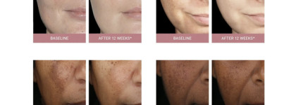 Неподражаемый фаворит 2024 - линия Eucerin Anti-Pigment