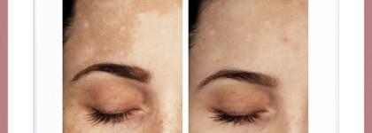 Неподражаемый фаворит 2024 - линия Eucerin Anti-Pigment