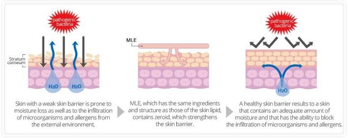Фото из интернета. На первом изображении разрушенный барьер активно теряет влагу, подвержен атакам бактерий, аллергическим реакциям и негативным факторам внешней среды. На втором - ламеллярная эмульсия восстанавливает барьер, заполняя повреждённые участки. На третьем - здоровый барьер не даёт влаге испаряться и защищает кожу от непрошенных гостей.