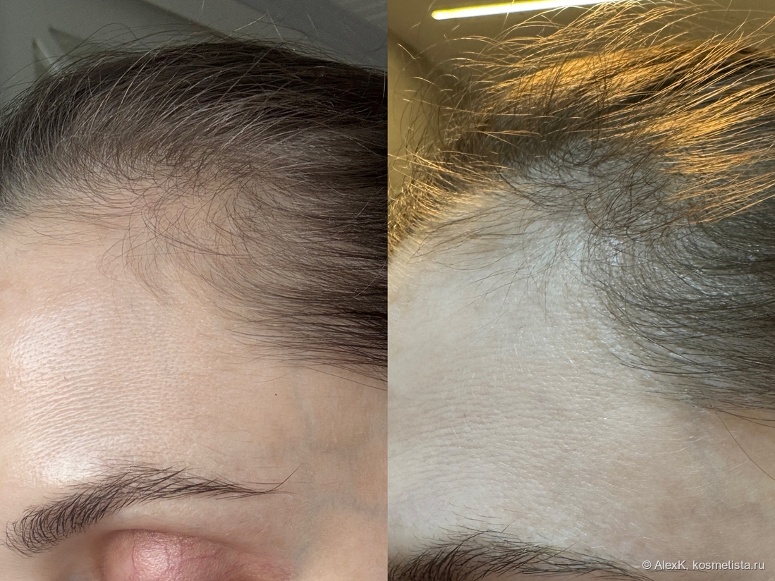 Не очень информативно. Я не дома и повторить оригинальное До не могу. Пока густота одинаковая. Но Посмотрим сюда же через месяц.