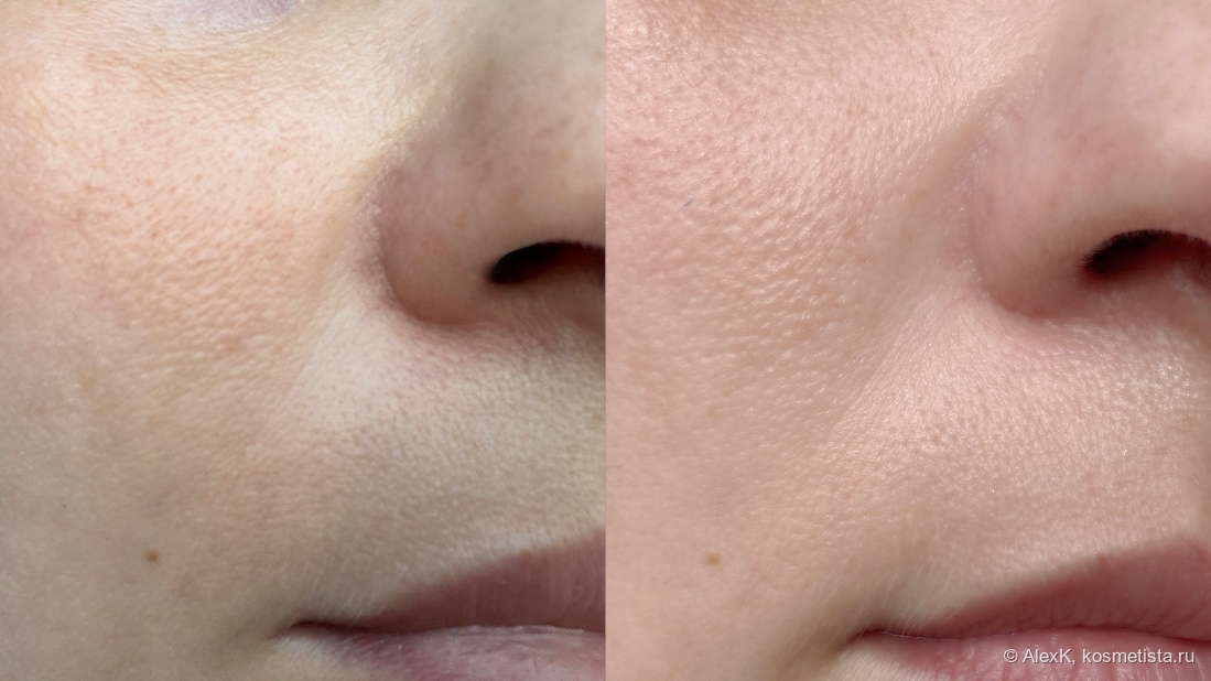 Кожа как-будто посвежее, но морщины на месте