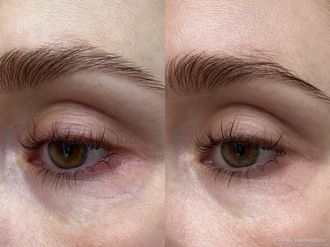 Не показательное до/после. У меня давно не было отеков под глазами. Но тут видно, что синева немного ушла: сыворотка поработала с сосудами. И кожа стала более напитанной, а мелкие морщинки немного разгладились.