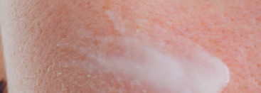 Увлажняющая сыворотка с тремя видами гиалуроновой кислоты Radmira