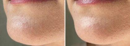 Lanolips Lemonaid Lip Treatment - мой N1 в уходе за губами