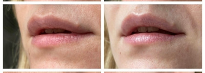 Пробую новое и жду чуда: обзор двух продуктов от La Roche-Posay