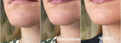 Beautydrugs Candy Melting Lip Balm в оттенке 04 Mystery - мой первый чёрный