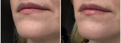 Vita Glazed Lip Mask от Tocobo - вроде бы и да, но есть нюансы