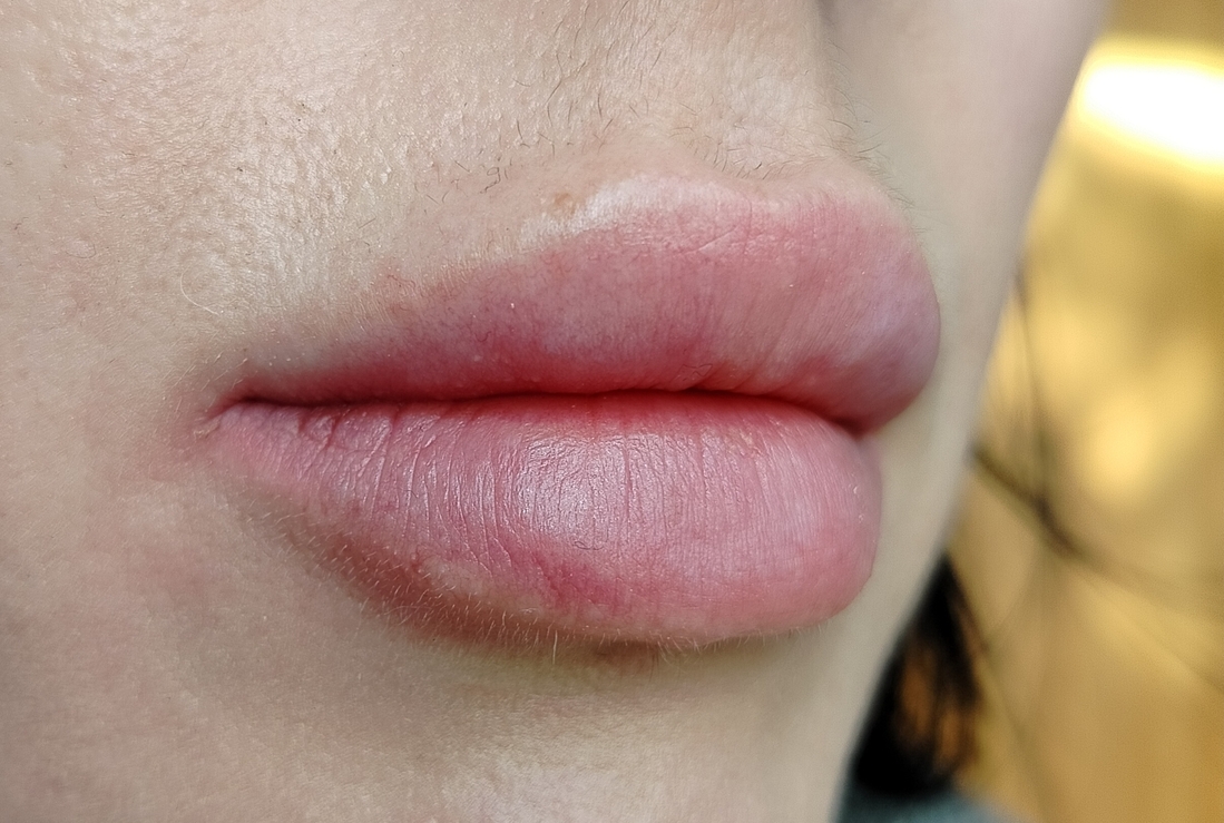 Мои губы до нанесения - сухие, немного потрескавшиеся