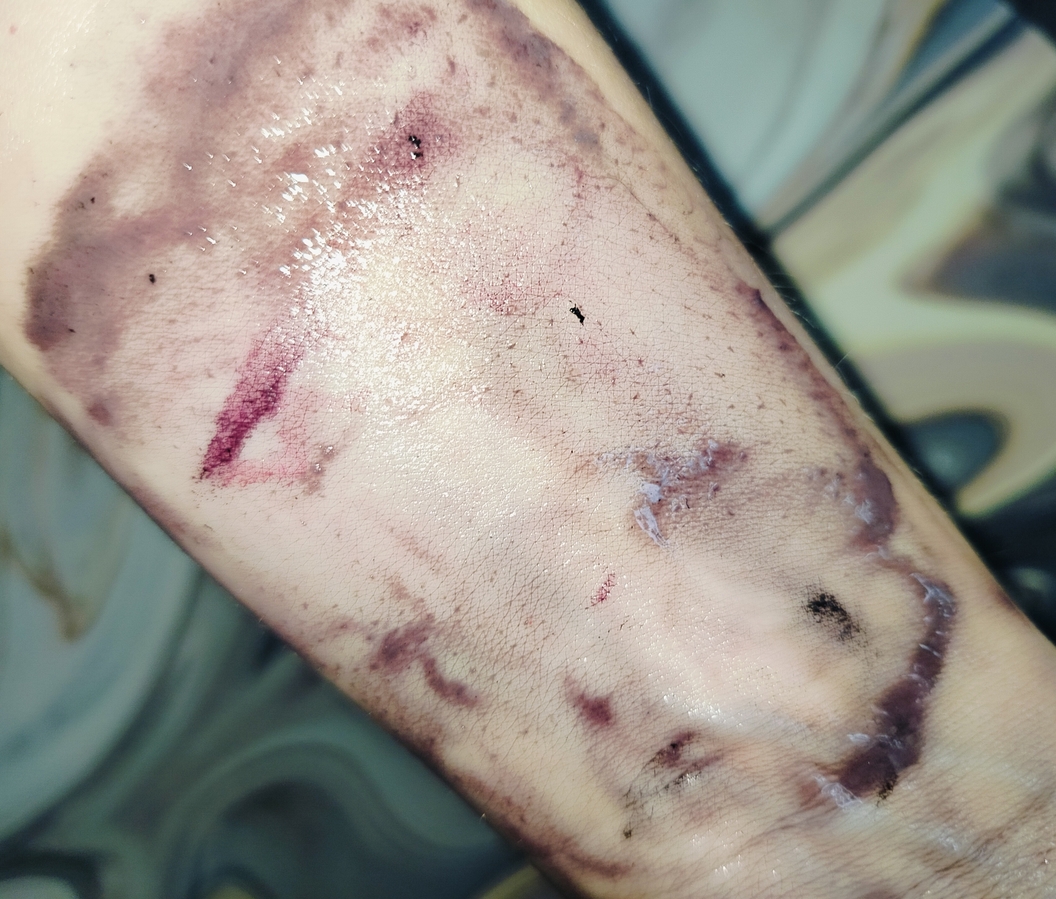 Видно, что большинство средств пенка растворила