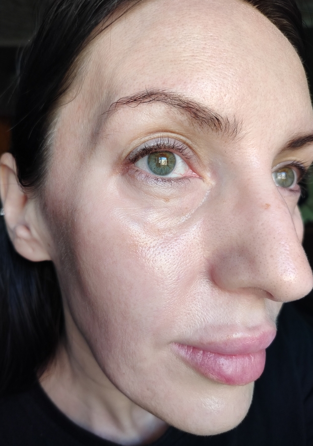 Кожа после нанесения эссенции